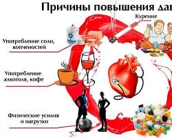 как понизить давление, народные средства от давления, быстро сбить давление, гипертония лечение без таблеток, medsanitar
